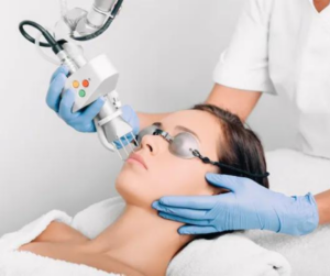 Fractional C02 Laser