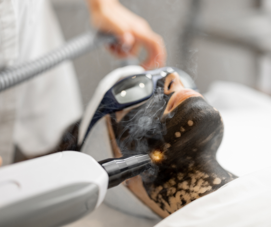 Laser Skin Rejuvenation - Carbon Facial