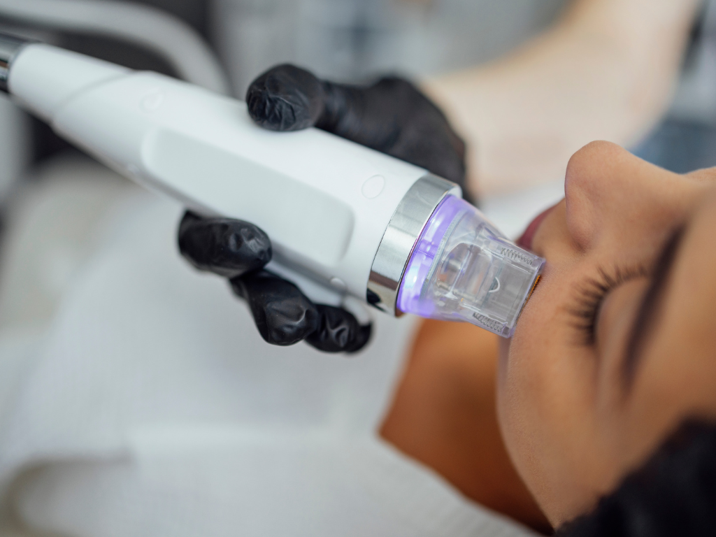 Fractional RF & Microneedling