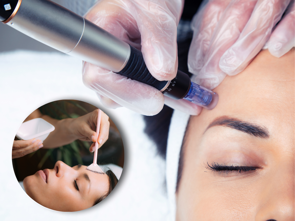 Chemical Peel & Microneedling Combo