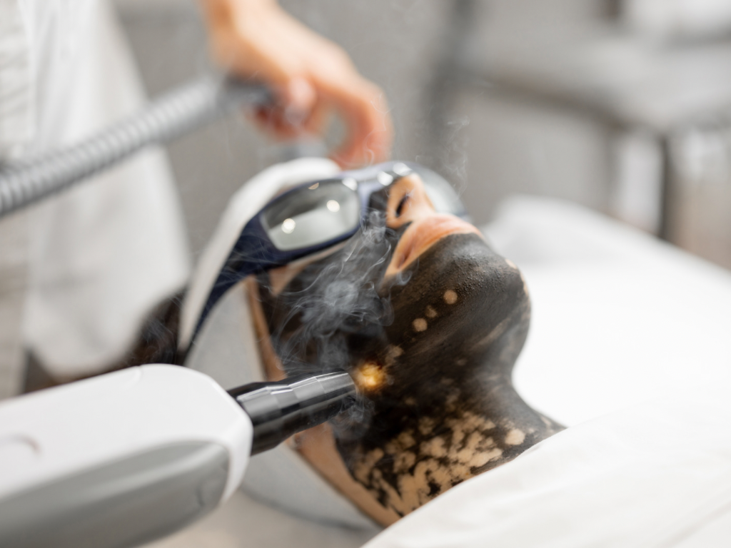 Carbon Laser Facial – Skin Clarity and Rejuvenation